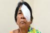 ఎడమ కంటికి బదులు కుడి కంటికి సర్జరీ.. సిరిసిల్లలో కలకలం