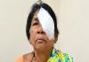 ఎడమ కంటికి బదులు కుడి కంటికి సర్జరీ.. సిరిసిల్లలో కలకలం