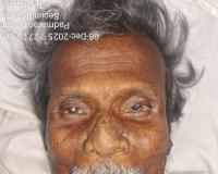 గాంధీ ఆస్పత్రిలో గుర్తుతెలియని వ్యక్తి మృతి