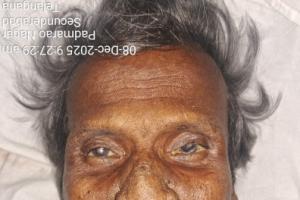 గాంధీ ఆస్పత్రిలో గుర్తుతెలియని వ్యక్తి మృతి